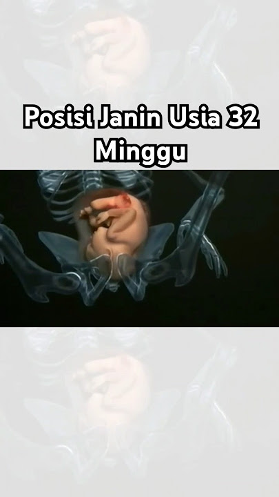 Posisi Janin Yang Diharapkan Pada Usia 32 Minggu
