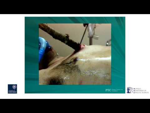 Oxford University Surgical Lectures: Primary Trauma Care