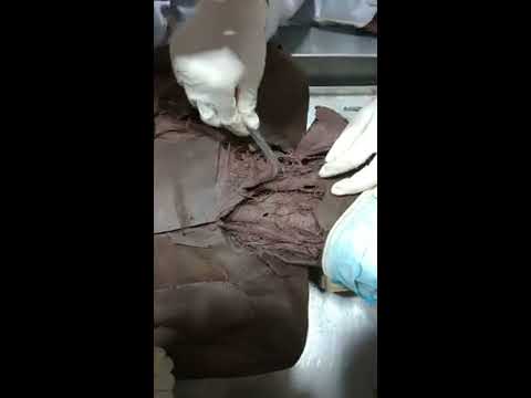 Video Thực tập Giải Phẫu trên xác thật Đại học Y Hà Nội #GP - youtube