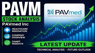 PAVM Stock Analysis | PAVmed Inc Stock Latest Chart and Business Overview
