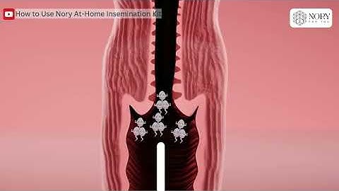 How to Use Nory At-Home Insemination Kit | Step-by-Step Guide for Safe and Easy Insemination at Home