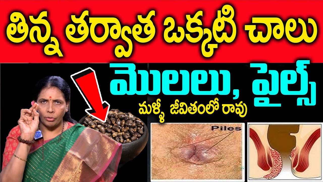 మజ్జిగలో కలిపి ఒక్కటి చాలు మొలలుశాశ్వతంగా మాయం | eliminate the warts forever | Yoga Guru Aruna Devi