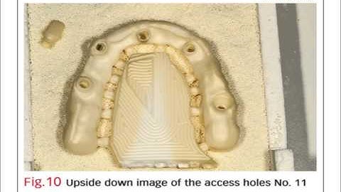 Bench Mastery: Kahng on an Ideal Implant Bridge