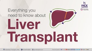 What is Liver Transplant Surgery | Types & Success rate | Liver transplant cost in Hyderabad, India