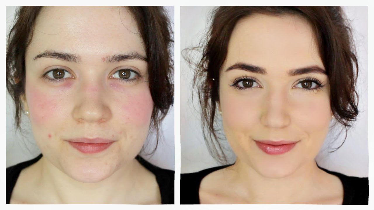 Børns dag klippe Betaling How To Cover Rosacea/Redness - YouTube