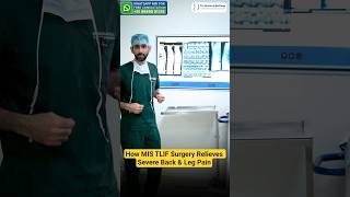 2-Level MIS TLIF Surgery for Severe Slipped Disc | Spine Surgery #slipdisc #spinehealth #cases