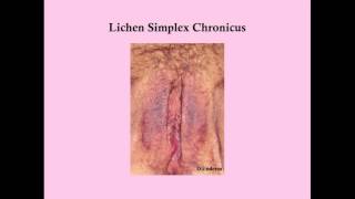 Benign Vulvar Epithelial Disorders - CRASH! Medical Review Series