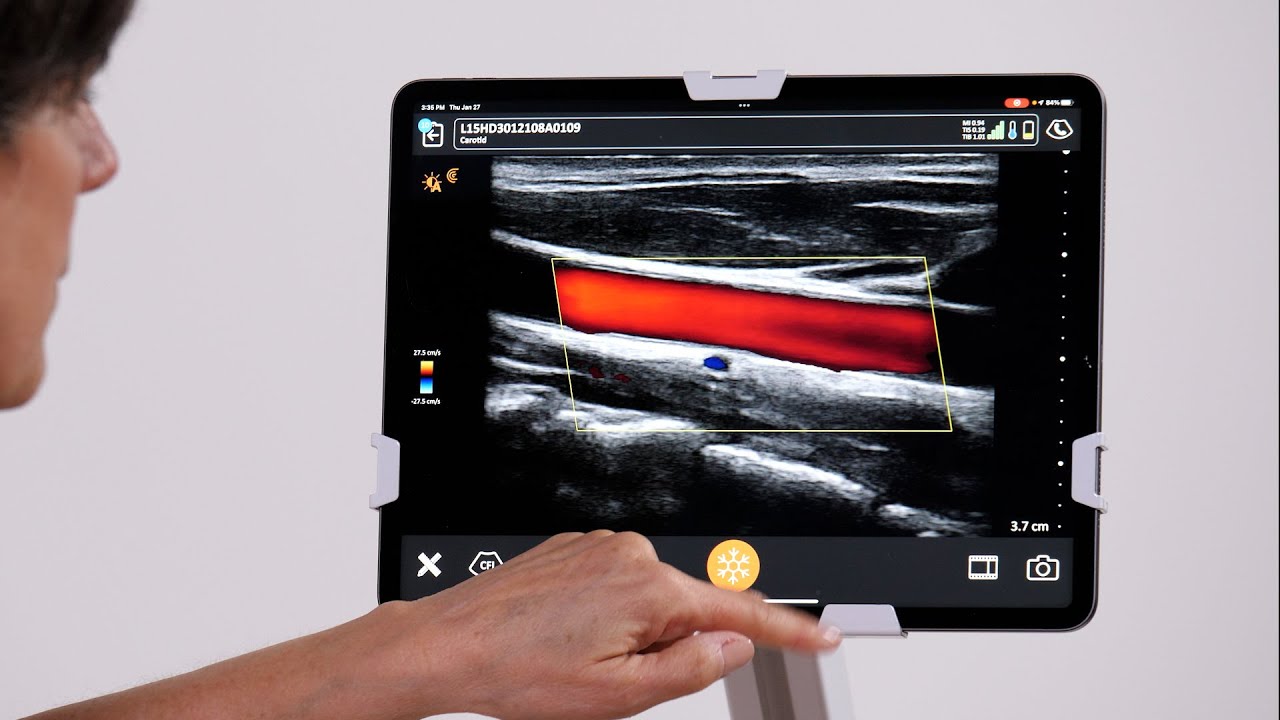 Режим цветного допплера