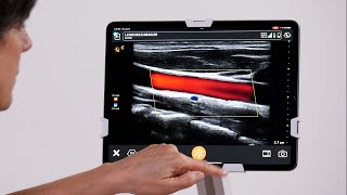 Color Doppler Mode