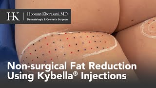lemon bottle fat dissolving nyc Reviews – Patient and Practitioner Insights 🍋 𝗖𝗮𝗻 𝘆𝗼𝘂 𝘂𝘀𝗲 𝗹𝗲𝗺𝗼𝗻