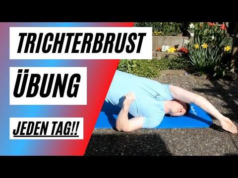 Video: Pectus Excavatum-Übungen: Verbessern Sie Die Kraft