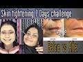 Skin Tightening Home Remedies| 7 दिन में फर्क देखो!”/Homemade serum +Collagen