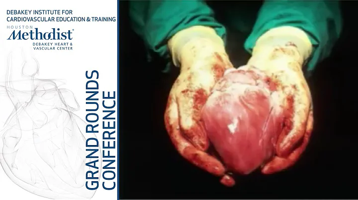 The Changing Landscape of Advanced Heart Failure (...