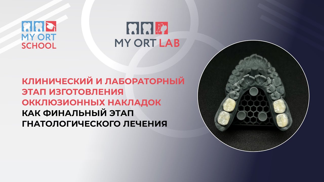 Клинический и лабораторный этап изготовления окклюзионных накладок
