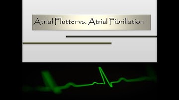 Atrial Flutter vs.Fibrillation