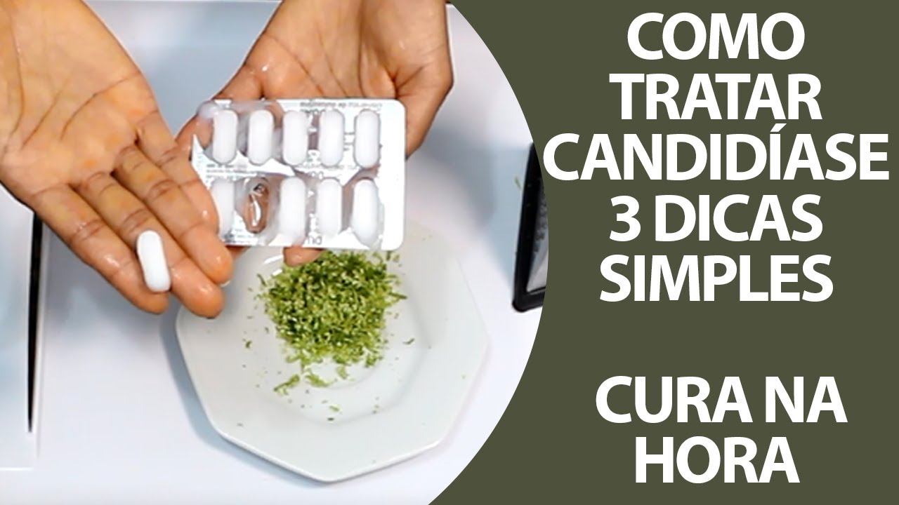 Candidíase Oral: Conheça Os Sintomas E Como Tratar – AQAN