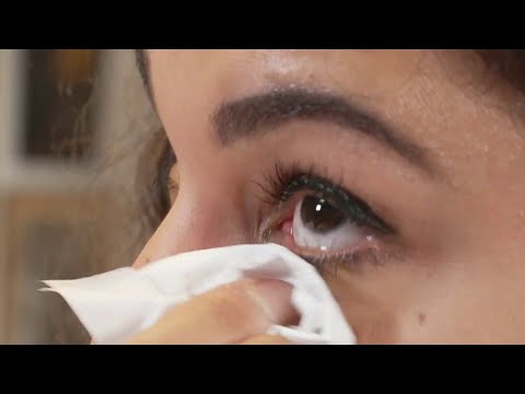 Vidéo: Après extension de cils yeux rouges - que faire ? Causes de la rougeur des yeux, méthodes pour éliminer le problème