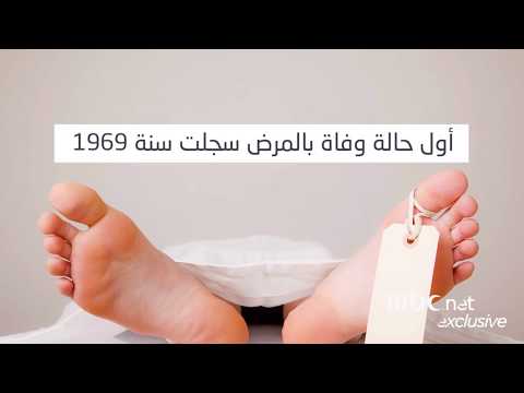 تعر ف على أعراض مرض كاروشي القاتل القادم من اليابان