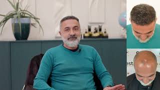 Arashs Remarkable Hair Transplant Journey 5-Month Check-In At Este Medical Leeds