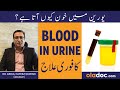 Hematuria Blood In Urine Treatment Peshab Men Khoon Ana Kaise Roken Bloody Urine Causes Solution Hematuria Blood In Urine Treatment Peshab Men Khoon Ana Kaise Roken Bloody Urine Causes Solution