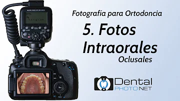 ¿Cómo se hacen fotos con ortodoncia?