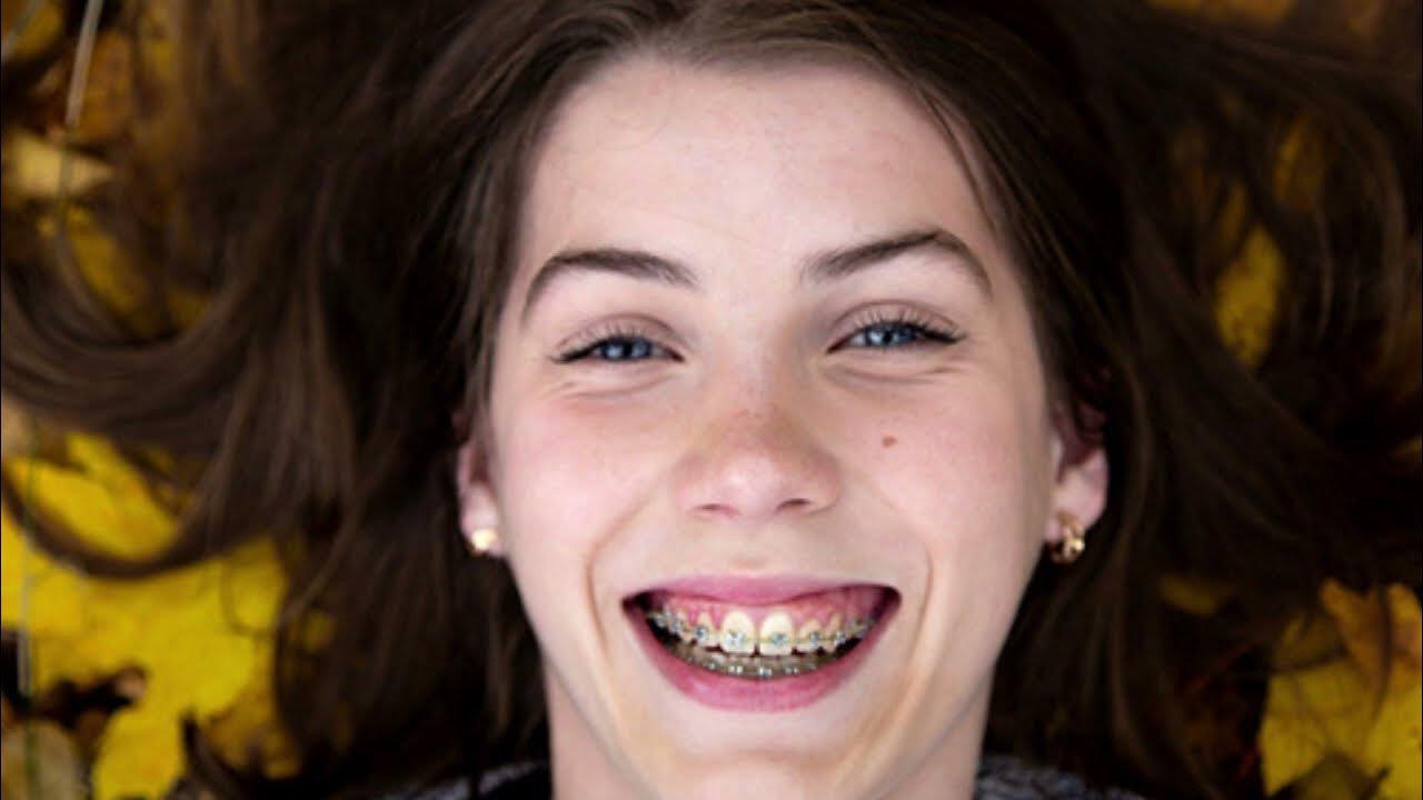 Can I eat cinnamon toast crunch with braces YouTube