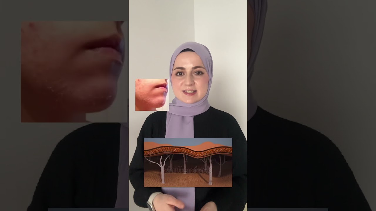 Retinol seçerken eczanedeki kremlerden uzak dur!