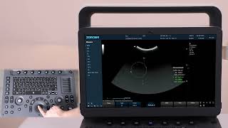 Zoncare M30 workflow video