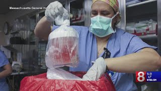 Yale New Haven Hospital excited about kidney transplant advancements