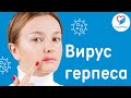 Вирус герпеса