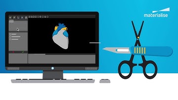 How to Go from Scan to 3D-Printed Anatomical Model | Mimics inPrint