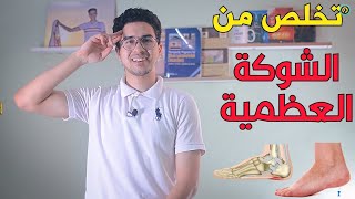 تخلص من الم الكعب نهائيا\الشوكة العظمية Heel Spur