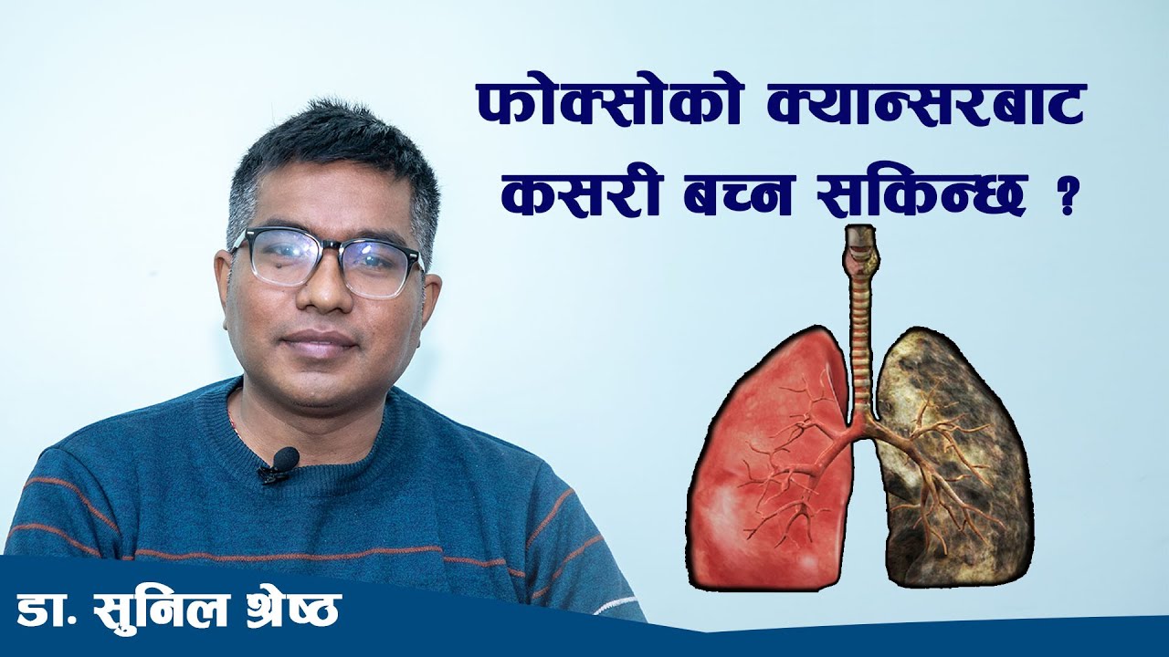 फोक्सोको क्यान्सरबाट कसरी बच्न सकिन्छ ? डा. सुनिल श्रेष्ठ, मेडिकल अन्कोलोजिष्ट