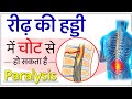 रीढ़ की हड्डी में चोट से हो सकता है Paralysis | Spinal Cord Injury Treatment | Dr. Puru Dhawan