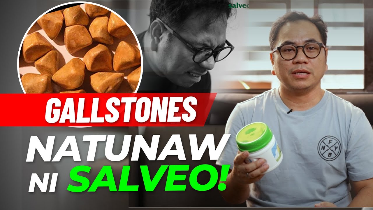 Natunaw ang gallstone dahil sa Salveo Barley Grass (Kwentong Salveo: Alvin Panganiban)