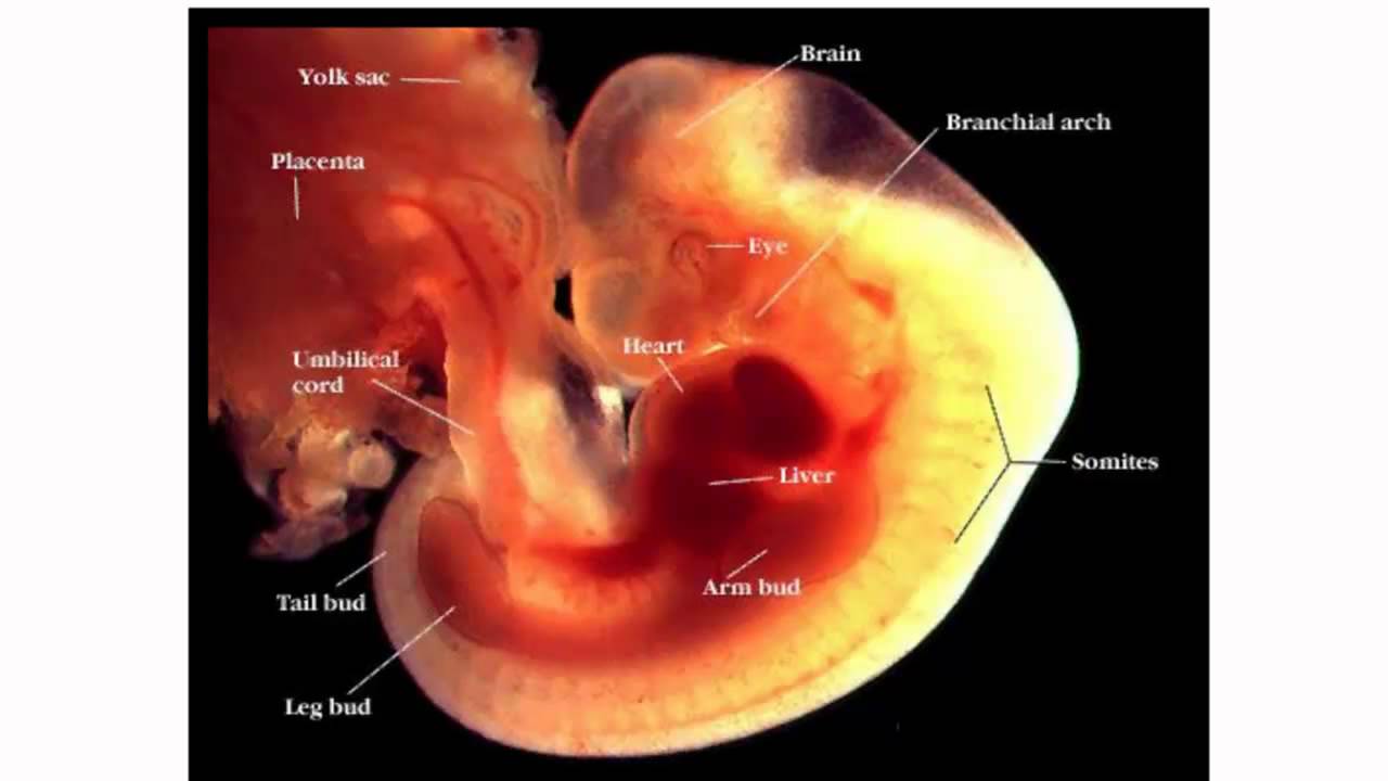 Pro-life and pro-choice perspective