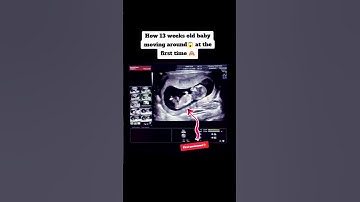 how 13 weeks old baby moving around first time|#pregnancy #ultrasound #viralshorts