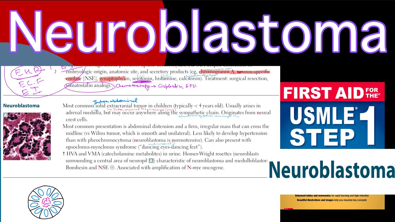 Neuroblastoma in Hindi/Urdu by first aid for USMLE step 1 - YouTube