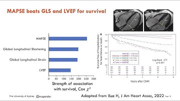 Left ventricular function - multimodality considerations & MAPSE, Prof Martin Ugander