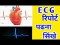 How To Read ECG || How to read ECG Report || ECG Reading In Hindi