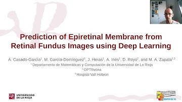 Prediction of Epiretinal Membrane from Retinal Fundus Images using Deep Learning