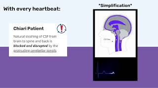 Chiari Academy - What is Chiari?