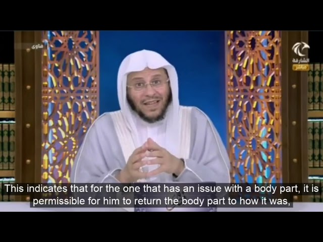 التفصيل في عمليات التجميل | حكم ضرب الإبر وتكبير الصدر أو الشفايف أو الخدود؟ | الشيخ د. عزيز فرحان