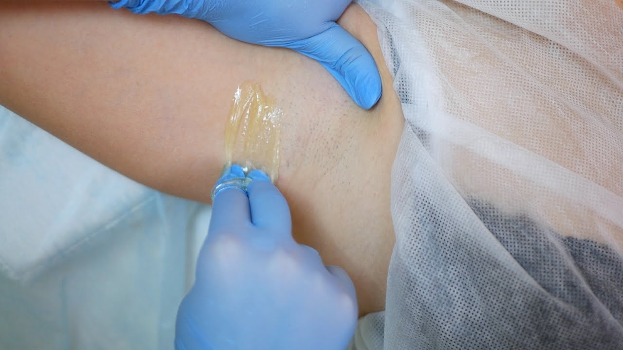 техника быстрый шугаринг подмышек, мой опыт и секреты - YouTube