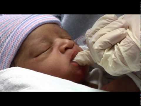 Tongue-Tied: Helping Babies Breastfeed
