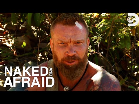 Anthony Suffers From Second Degree Sunburns! | Naked and Afraid | Discovery