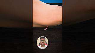 नंगे पैर चलने से शरीर में घुस जाता है ये कीड़ा 🪱😨 | Hookworm Facts in Hindi
