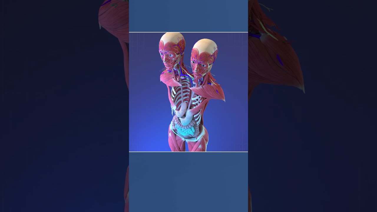Two Heads One Body Anatomy Of Conjoined Twins