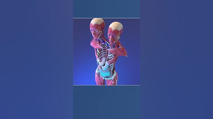 Two Heads, One Body: Anatomy of Conjoined Twins