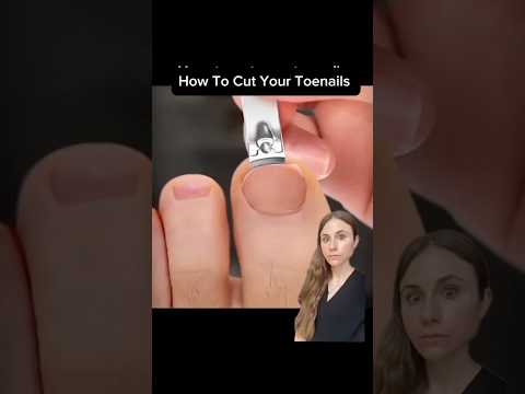 Cara Mencegah Kuku Cantengan